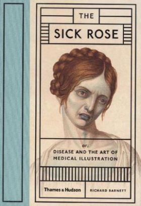 The Sick Rose